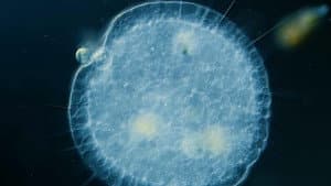 Heliozoa: Round, Sticky, and Covered in Spikes