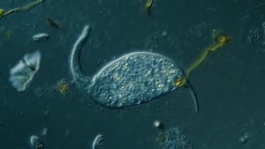 Dileptus: The Toxic Micro Elephant With an Insatiable Appetite