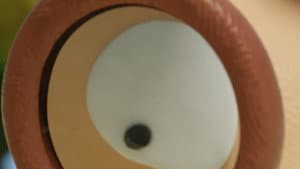 Episode 12