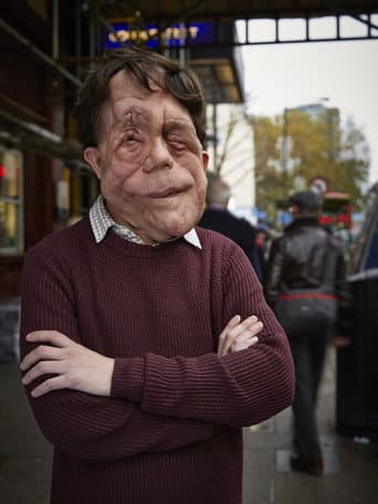 The Ugly Face of Disability Hate Crime (2015) poster