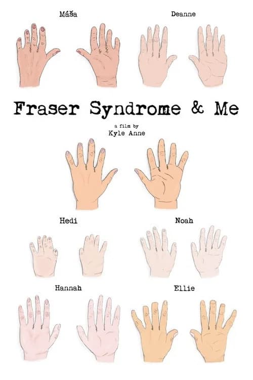 Fraser Syndrome & Me poster
