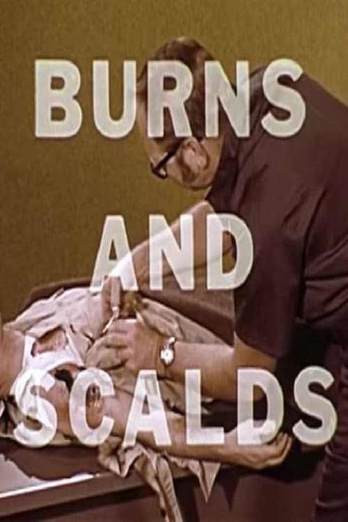 Burns And Scalds poster